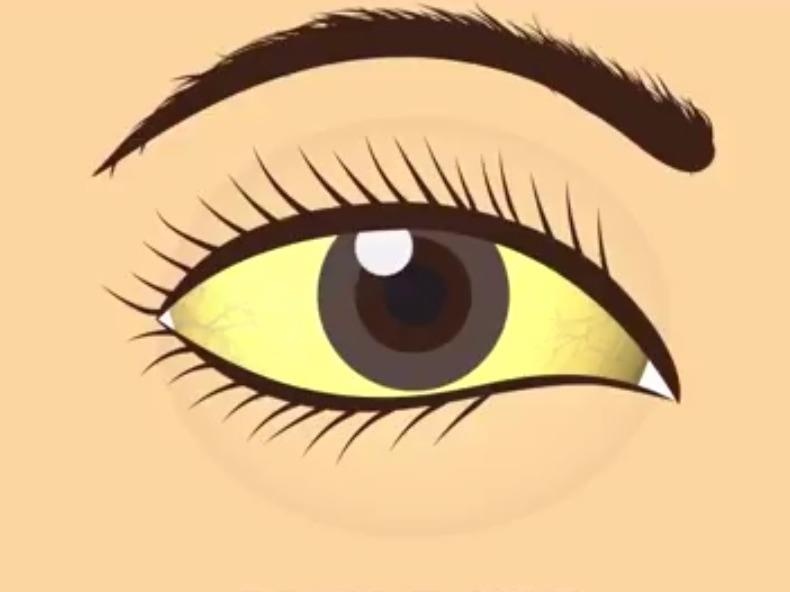 Dau hieu bat thuong o mat canh bao suc khoe co van de hinh anh