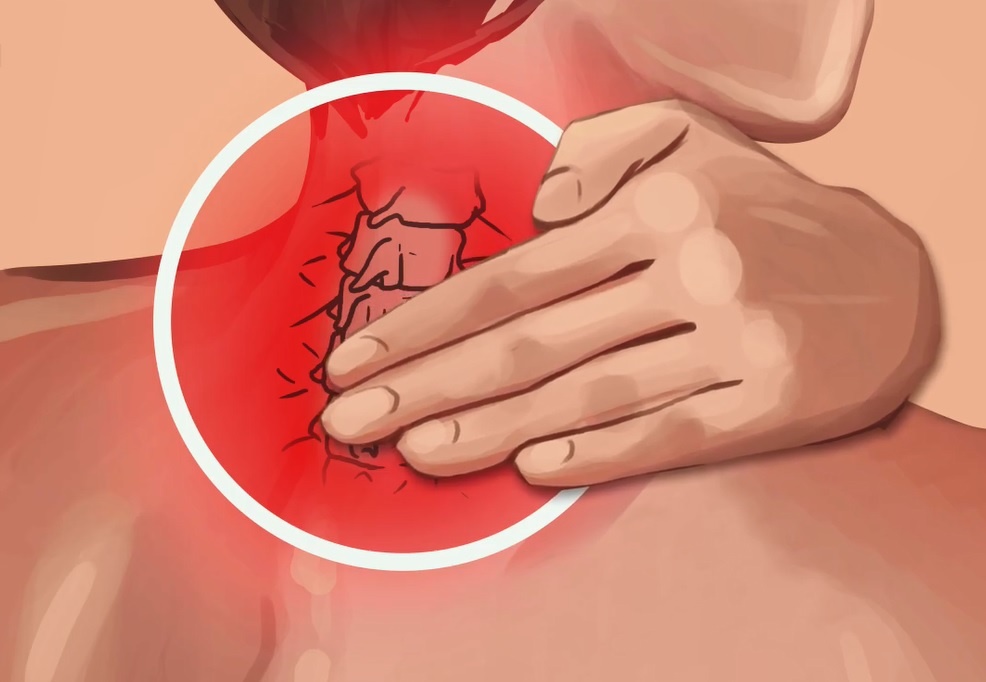 6 bai tap giup giam dau co hieu qua hinh anh