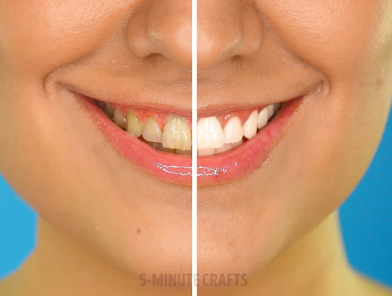 6 cong thuc lam trang rang tu nhien hinh anh