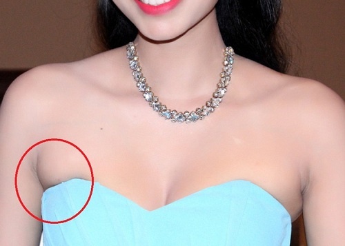 Bai tap giup loai bo mo vung duoi canh tay hinh anh