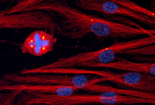 Benh ung thu duoi kinh hien vi anh 1