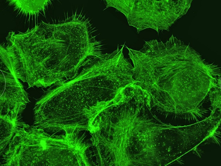 Benh ung thu duoi kinh hien vi anh 6