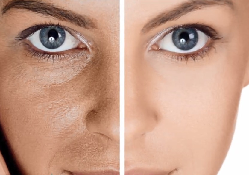 Cach tri mun dau den tai nha trong 2 phut hinh anh