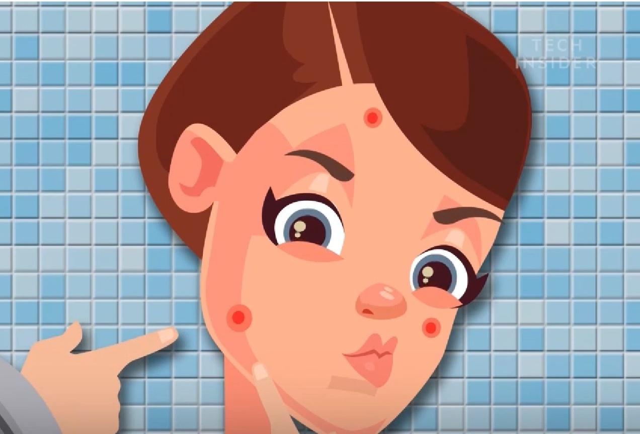 Co gi ben trong mot not mun? hinh anh