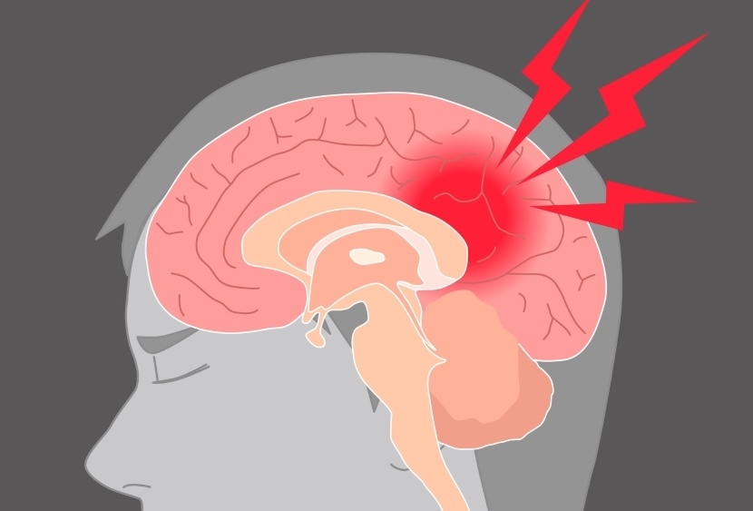 Dieu gi xay ra voi nao bo khi ban bi dap vao dau? hinh anh