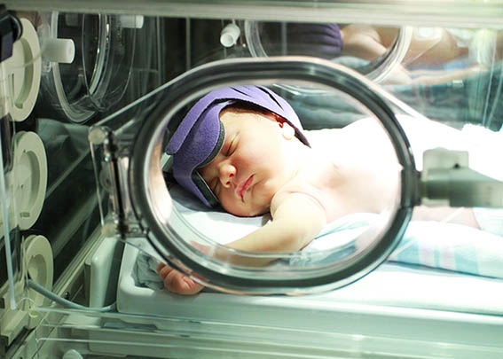 Vàng da sinh lý và vàng da bệnh lý ảnh 4 Vang da sinh ly va vang da benh ly anh 4