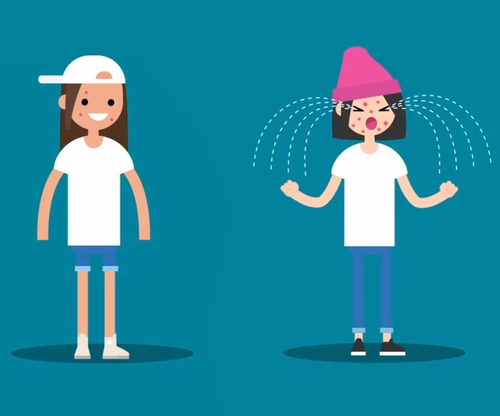 Tai sao mot so nguoi lai bi mun nghiem trong? hinh anh