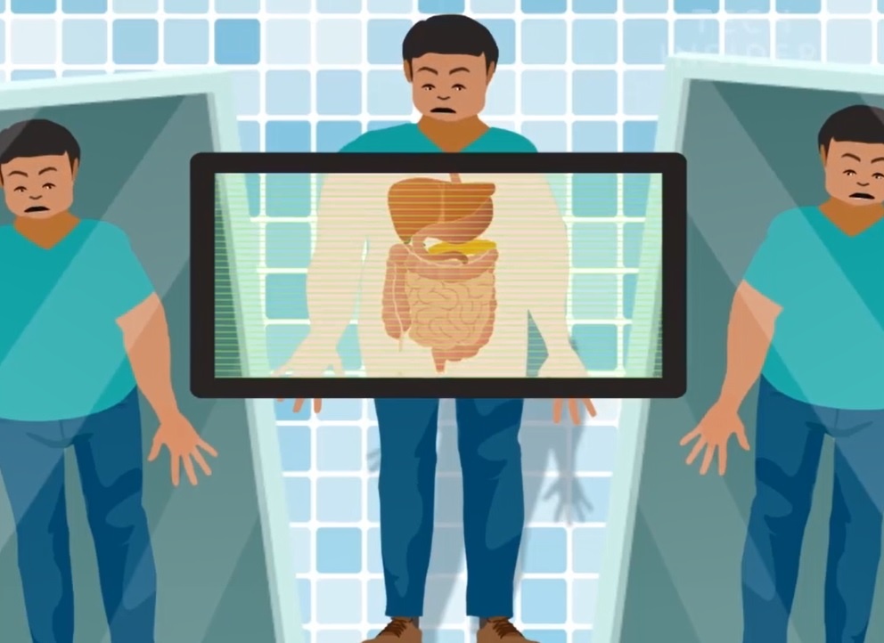 Thua can tac dong den co the nhu the nao? hinh anh