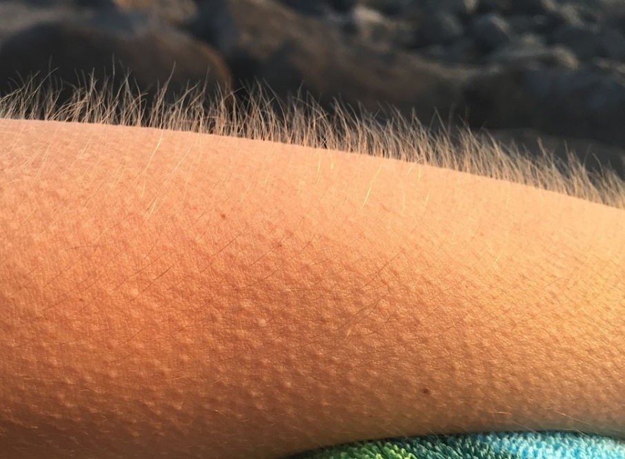 5 bo phan tro nen vo dung sau khi con nguoi tien hoa hinh anh