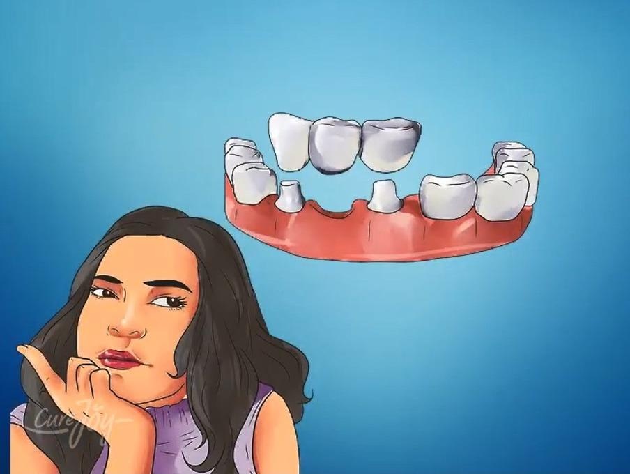 5 dau hieu canh bao xuong co van de hinh anh