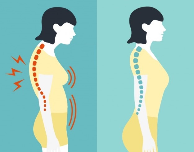 Bai tap cai thien tu the chi voi 5 phut moi ngay hinh anh