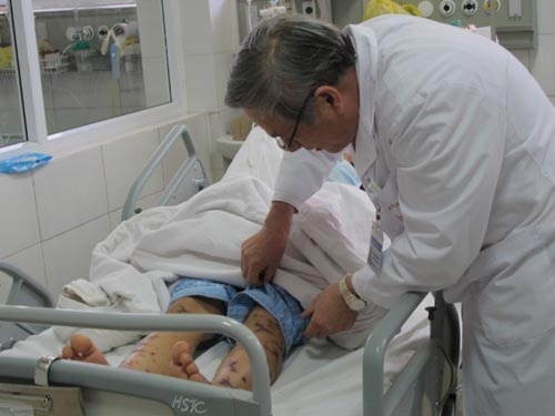 Mot phu nu dan toc 24 tuoi nguy kich do viem nao mo cau hinh anh