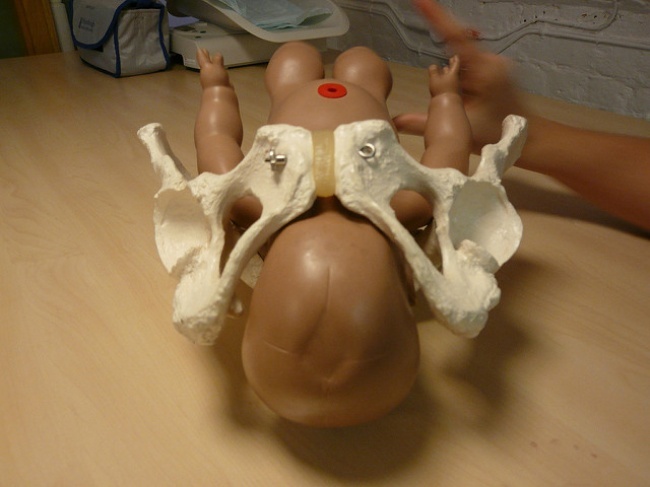 Hieu lam khi mang thai anh 7