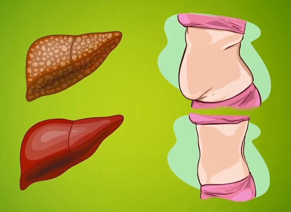 6 dau hieu canh bao gan chua day doc to hinh anh