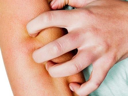 Dau hieu canh bao luong duong huyet qua cao trong co the hinh anh