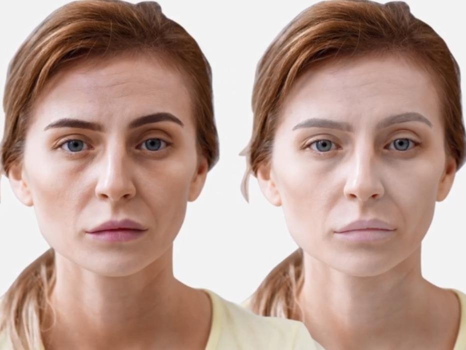 8 dau hieu bat thuong tren mat canh bao benh hinh anh