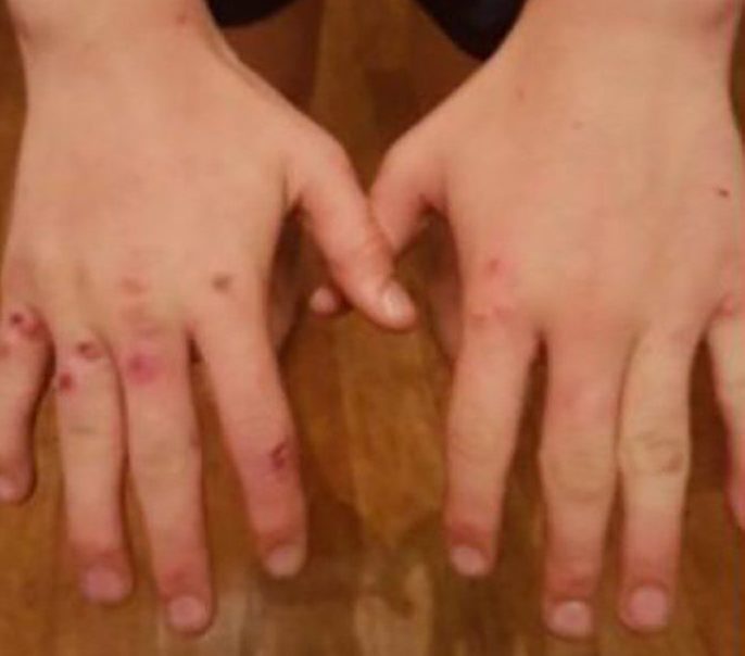 Cau be mac can benh tuong da 'tuyet chung' hinh anh