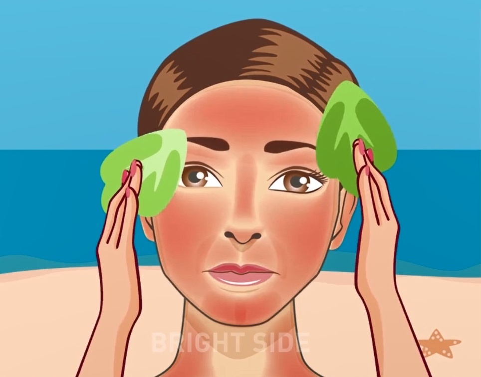 6 cach lam giam dau rat khi da bi chay nang hinh anh