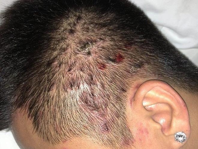 Lam gi de khong mac phai can benh khien ca si Tuan Hung khon kho? hinh anh