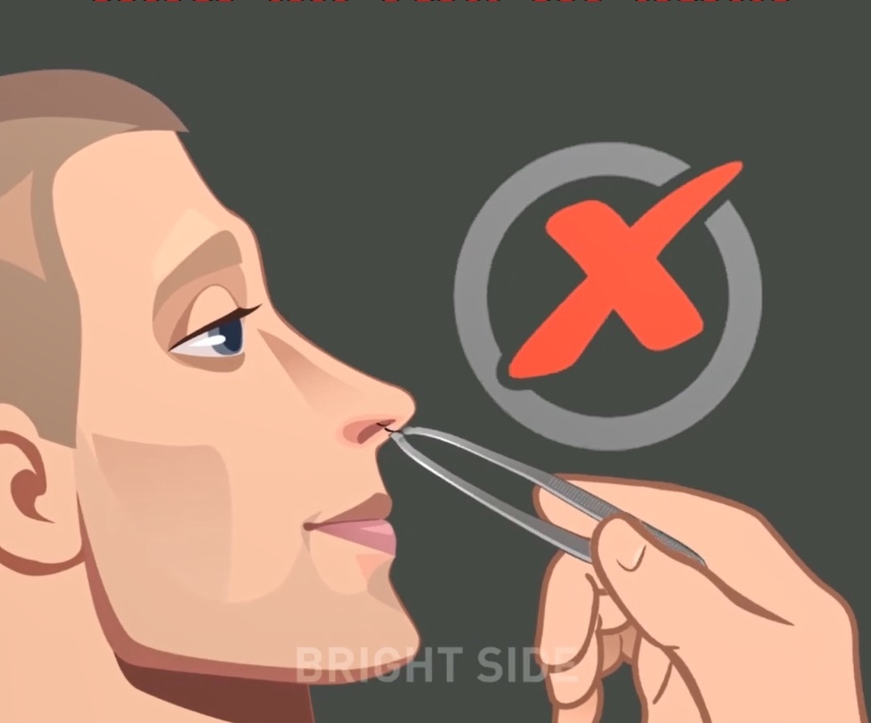 Tai sao ban khong nen nho long mui? hinh anh