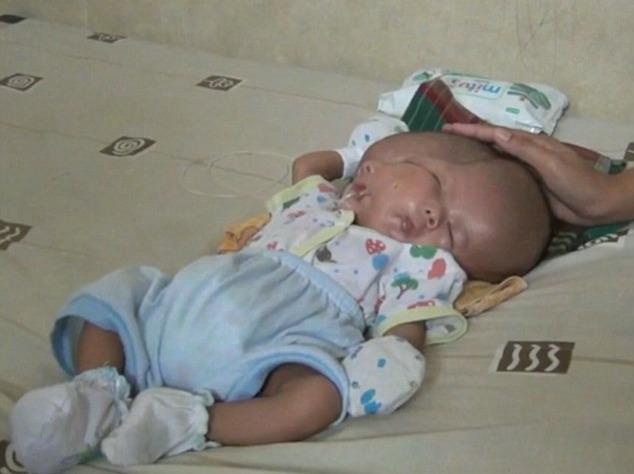 Em be co hai mat, hai nao nhung chung mot co the hinh anh