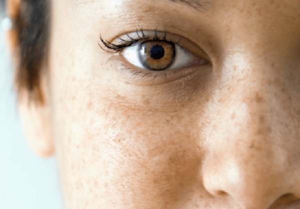 Nguyen nhan khong ngo gay nam, sam da hinh anh