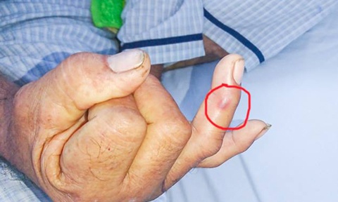 Đối phó với rắn lục đuôi đỏ ảnh 1 Doi pho voi ran luc duoi do anh 1