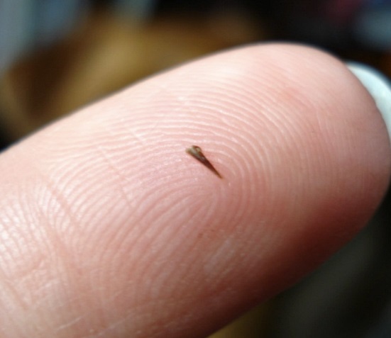 Nguy hiem khon luong khi bi dam dam vao tay hinh anh