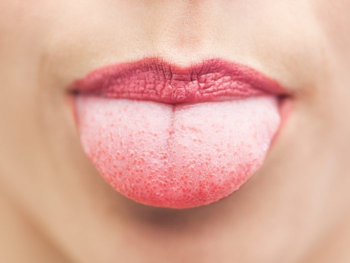 Cach loai bo luoi trang hieu qua hinh anh