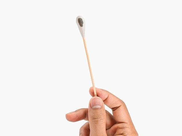 Doan benh qua mau sac cua ray tai hinh anh