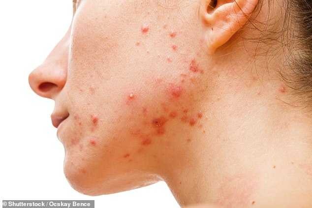 Dấu hiệu bệnh nguy hiểm ảnh 1 Dau hieu benh nguy hiem anh 1