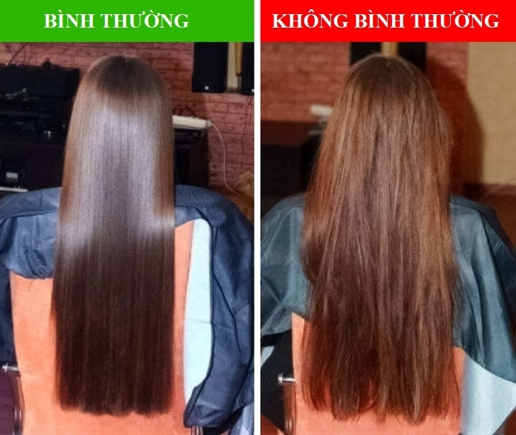 Bat thuong o mai toc anh 1