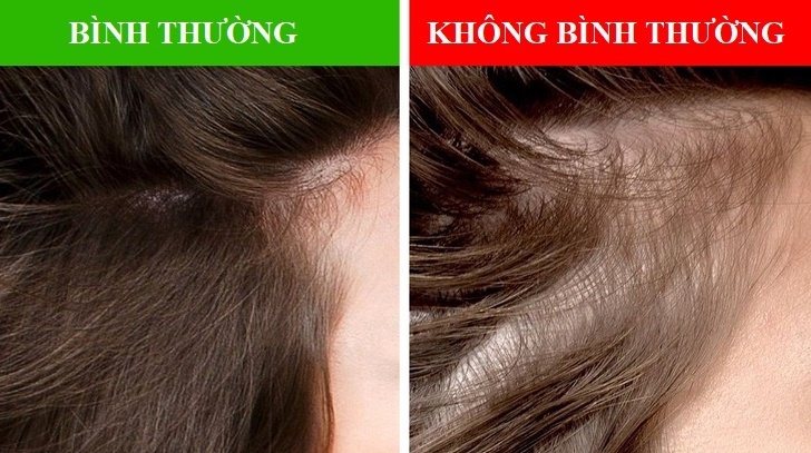 Bat thuong o mai toc anh 4