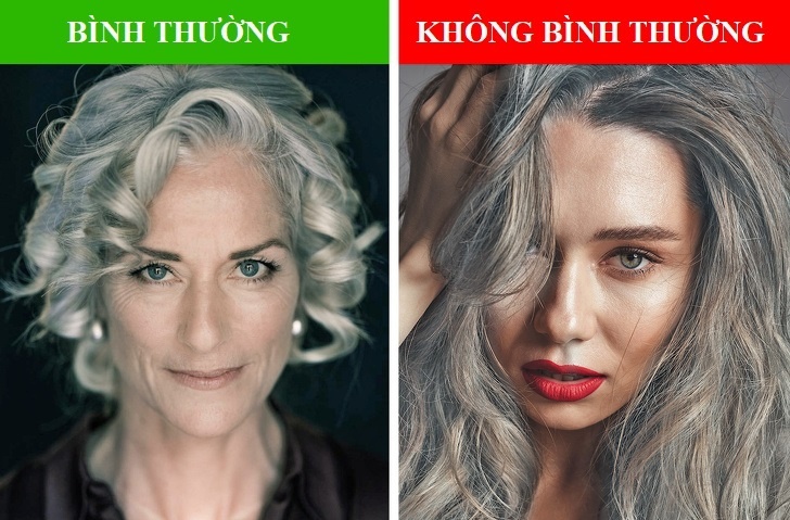 Nhung bat thuong o mai toc canh bao suc khoe co van de hinh anh