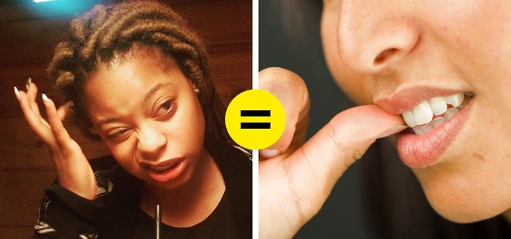 Bat thuong o mai toc anh 7