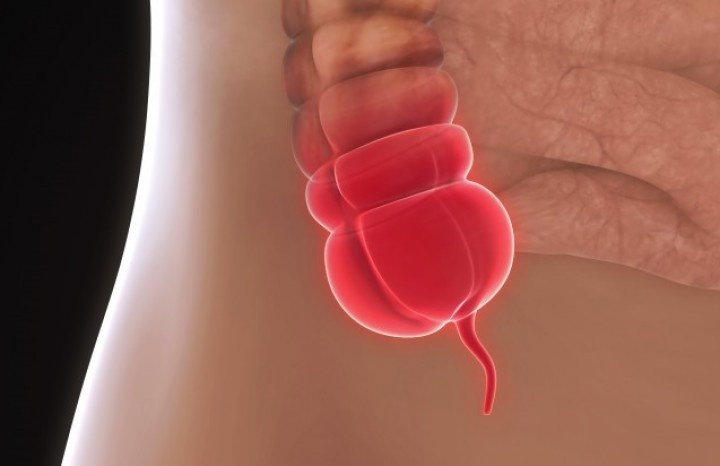 Dấu hiệu viêm ruột thừa ảnh 11 Dau hieu viem ruot thua anh 11