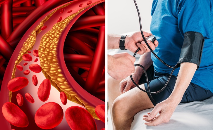 Can benh gay beo phi anh 6