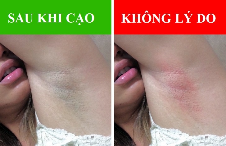 Dau hieu bat thuong o nach anh 2