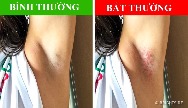 Dau hieu bat thuong o nach anh 3
