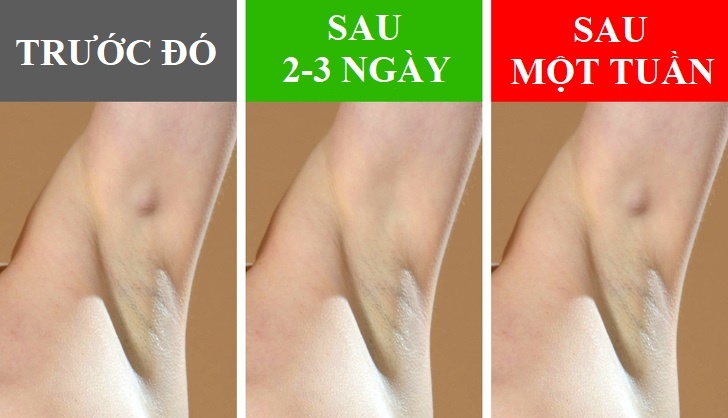 Dau hieu bat thuong o nach anh 5