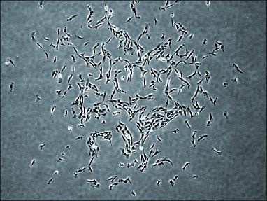 Te bao goc trong xuong nguoi anh 2