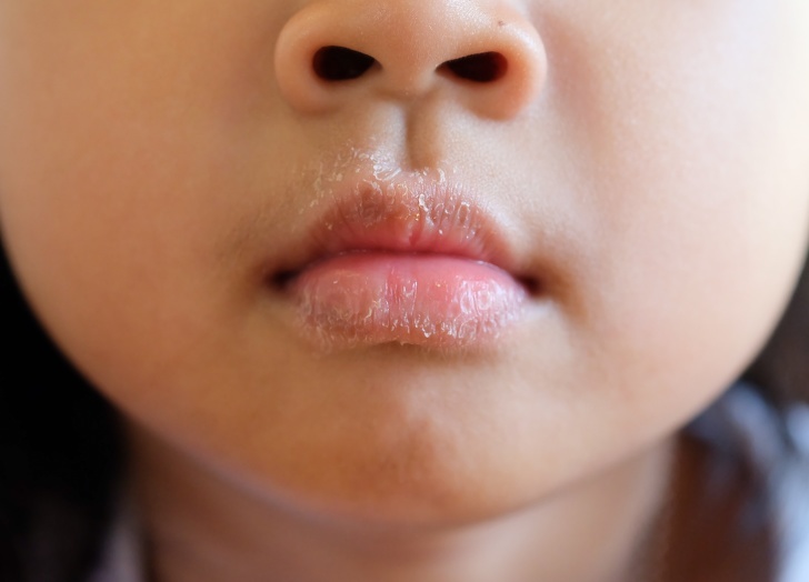 Bat thuong tren co the anh 1