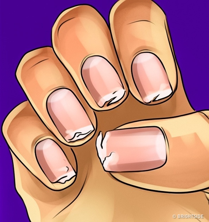 Dau hieu thieu canxi anh 7