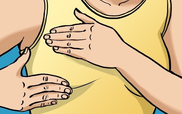 Dau hieu co the phu nu qua du thua estrogen hinh anh