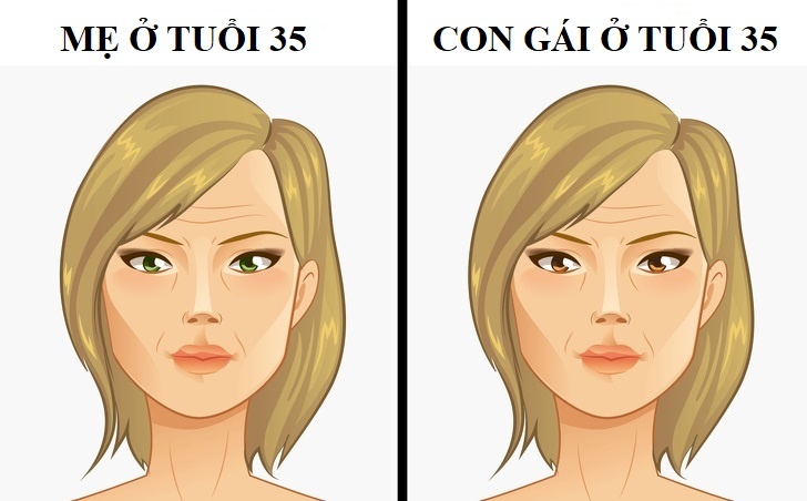 Con gai co the mac benh di truyen nao tu me? hinh anh