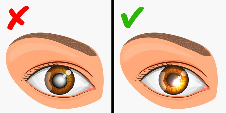 Benh di truyen tu me sang con gai anh 5