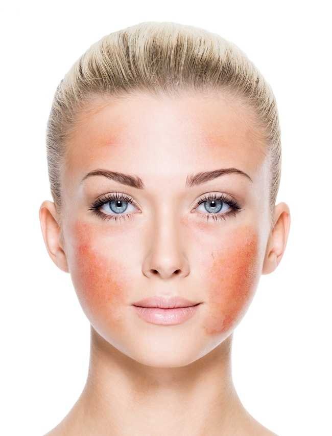 San pham gay hai da anh 1