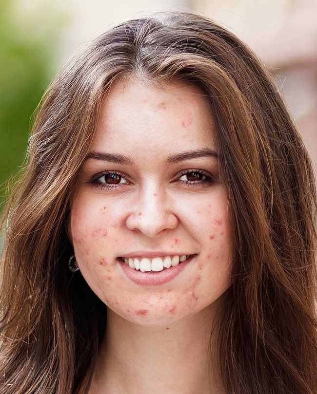 San pham gay hai da anh 2