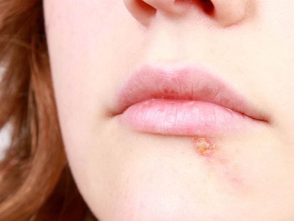 Moi nut ne canh bao benh anh 7