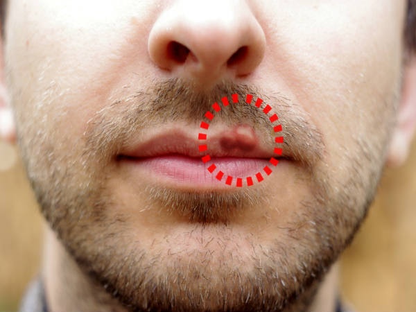 Moi nut ne canh bao benh anh 8